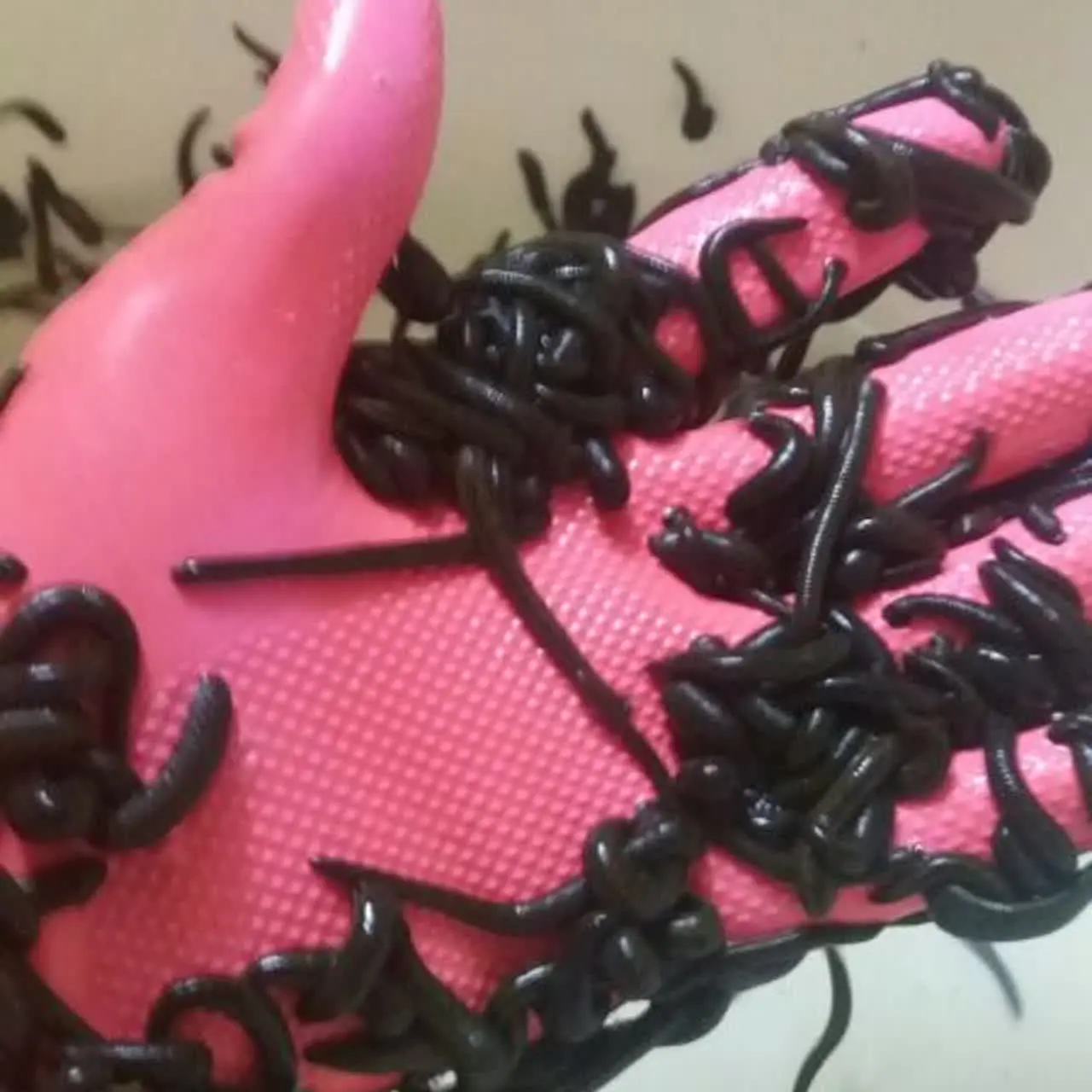 کانال درمانی