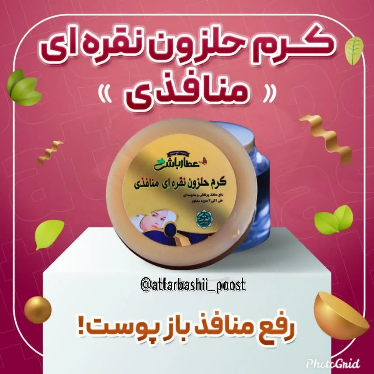 #کرم_حلزون_نقره_ای_منافذی
