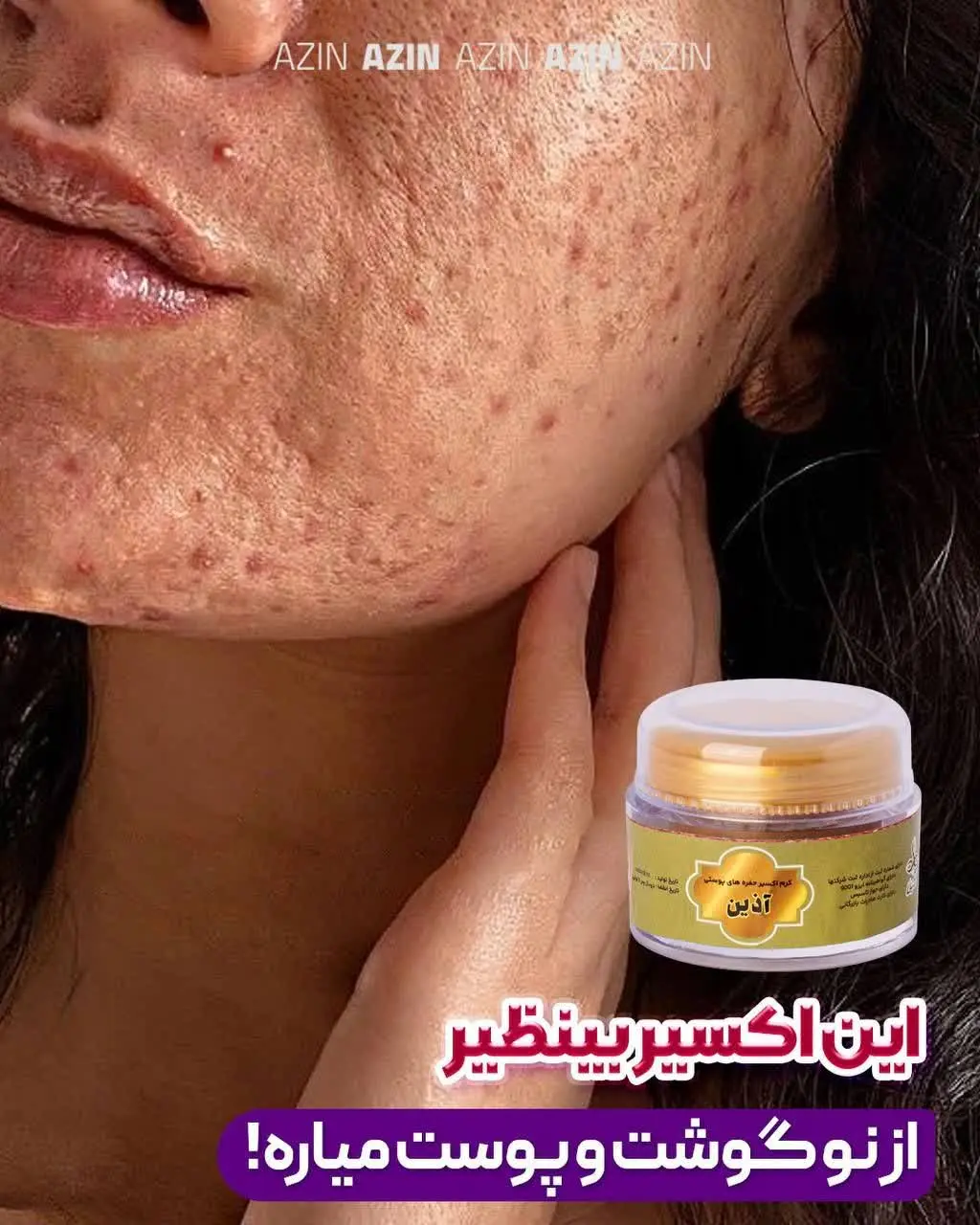 💁🏻‍♀️اذین کرم بینظیر اکسیر (رویاننده گوشت و پوست) اورده😍
