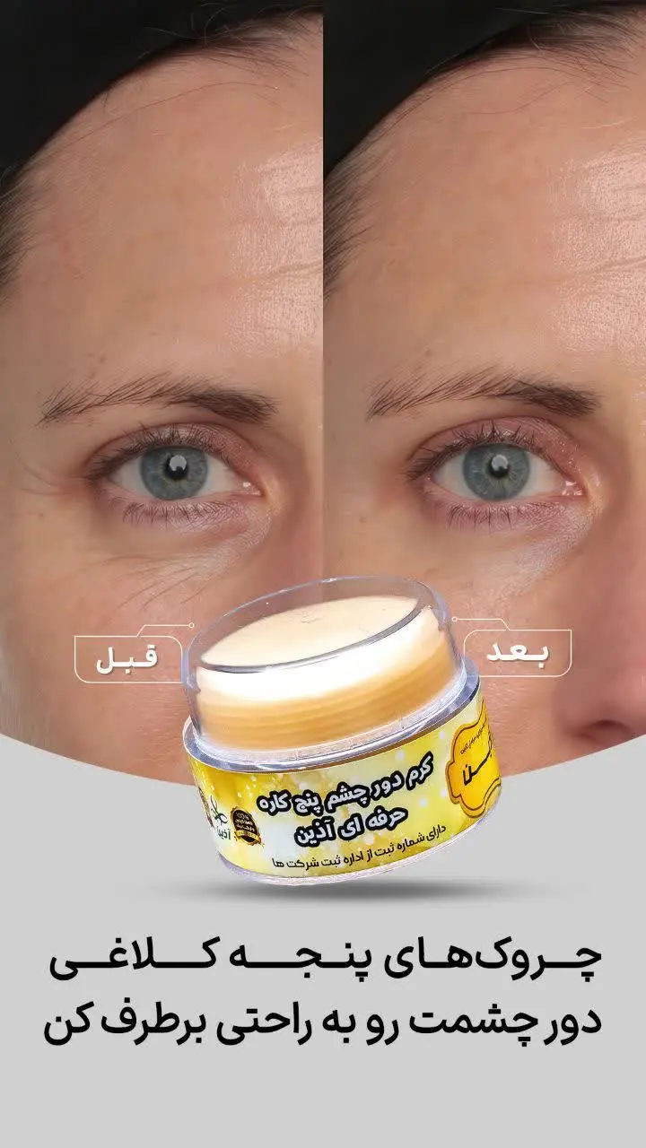 کرمدورچشم حرفه ای یک کرم فو...