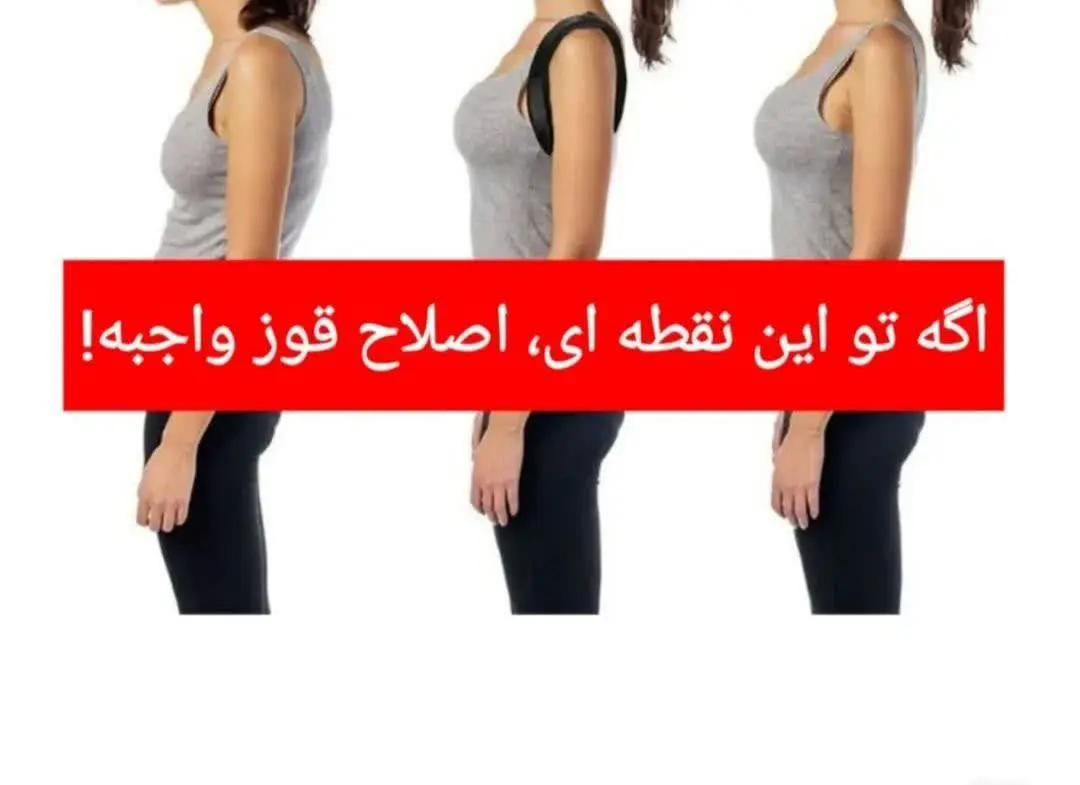 اگر بچت توی سن رشد قوز می‌کنه، واجبه یه قوزبند استفاده کنه تا یک عمر استیل صاف و محکم داشته باشه 🥰
