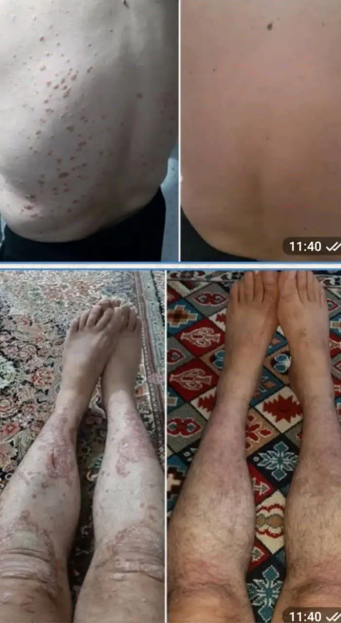 🤩🤩#پماد_معجزه_آسا 
