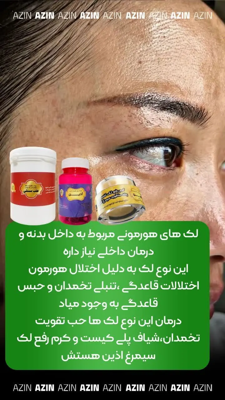 درمان این نوع لک ها حب تقوی...