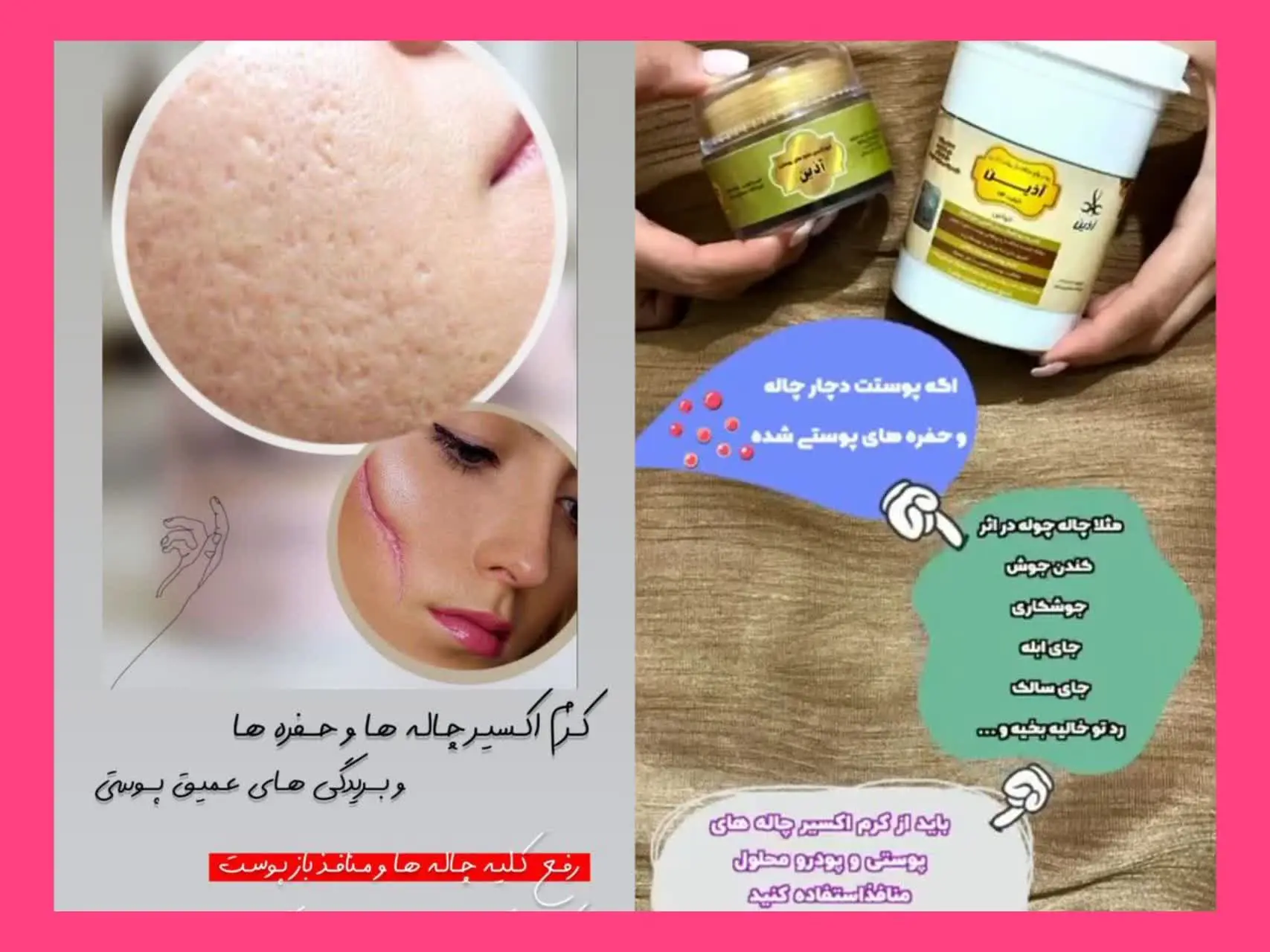 (بازسازی کننده تخصصی با فرم...