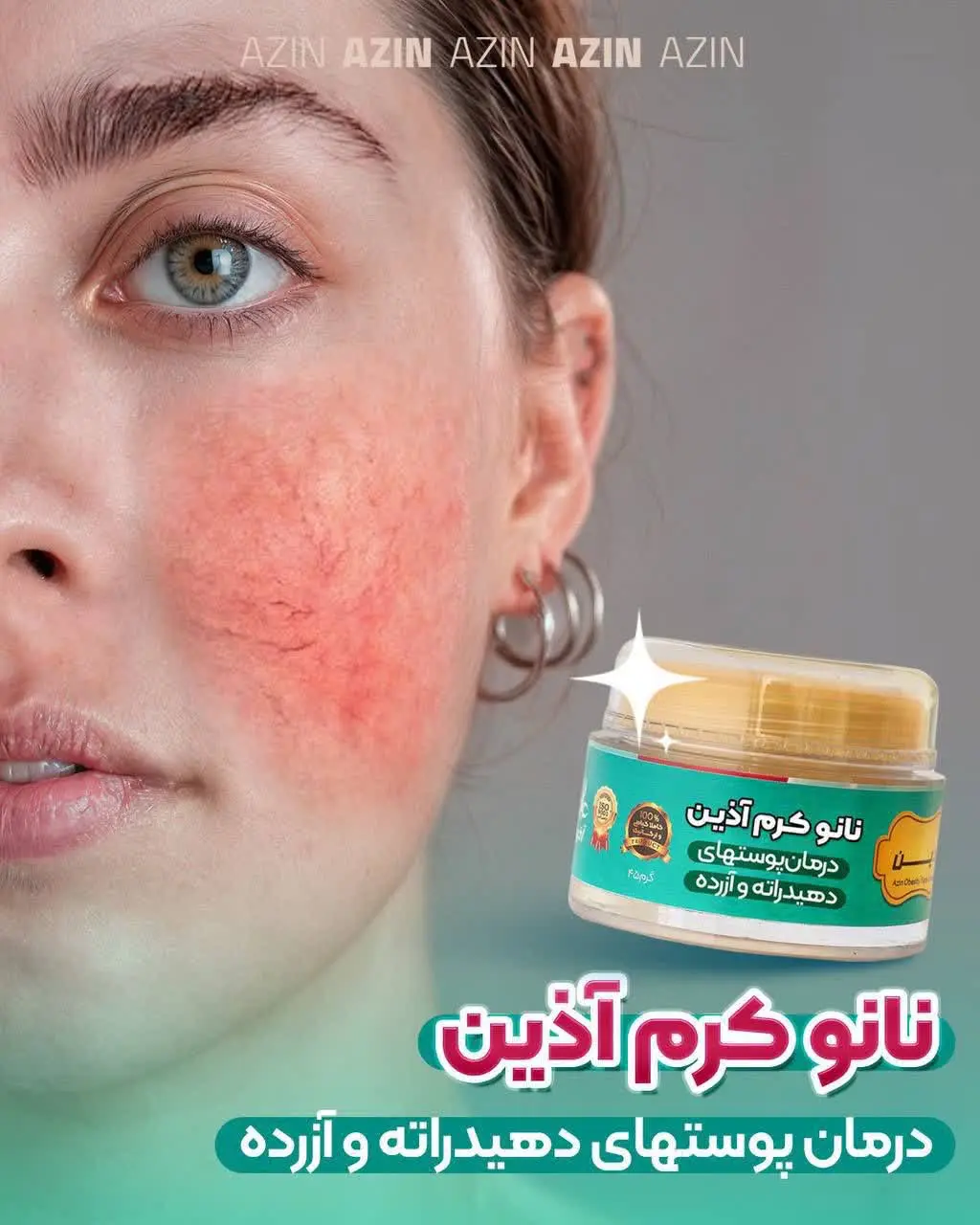 ️درمان پوست دهیدراته