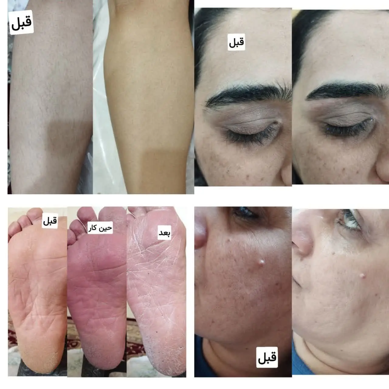 پاکسازی صورت با بهترین مواد...