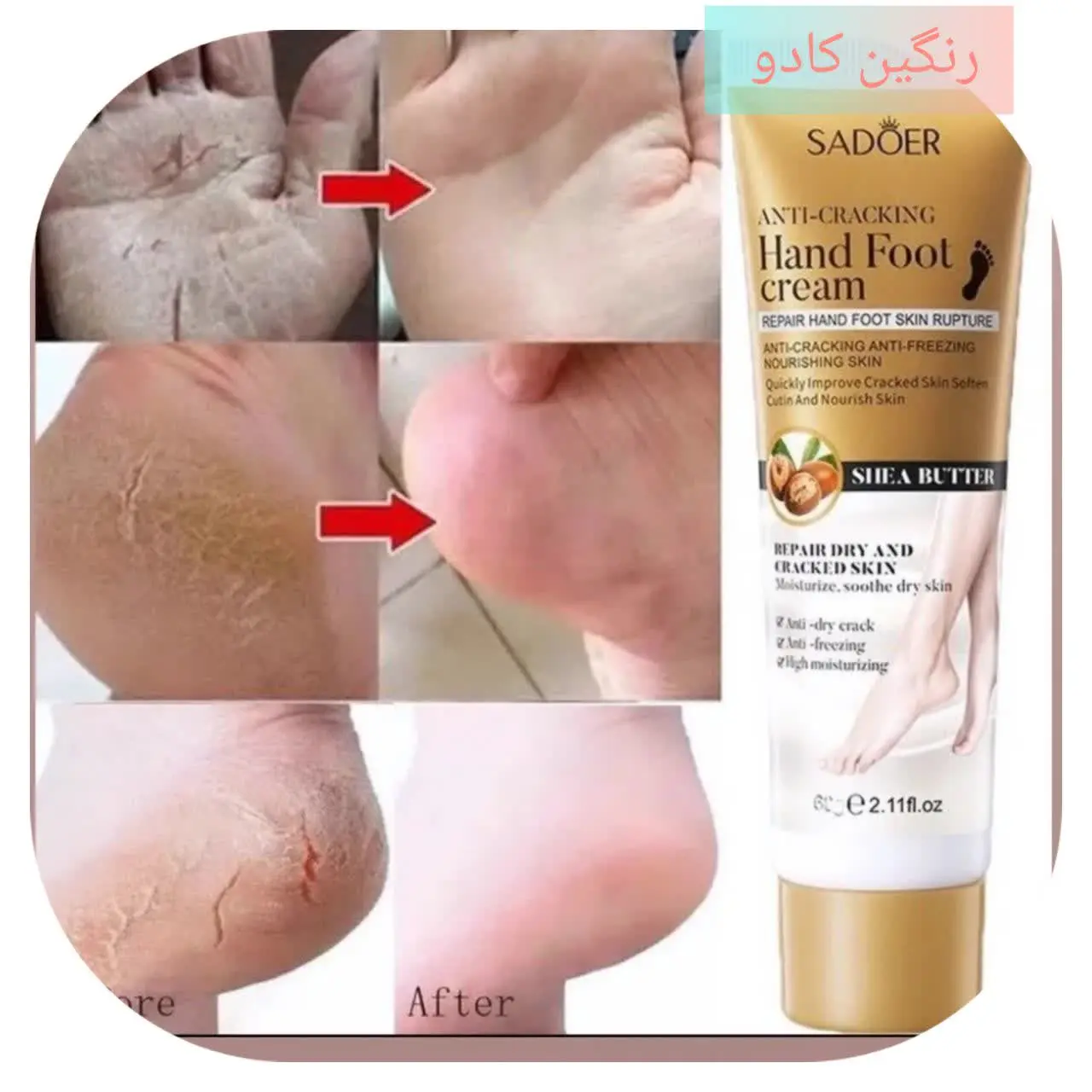 🎀کرم ترک پا🎀