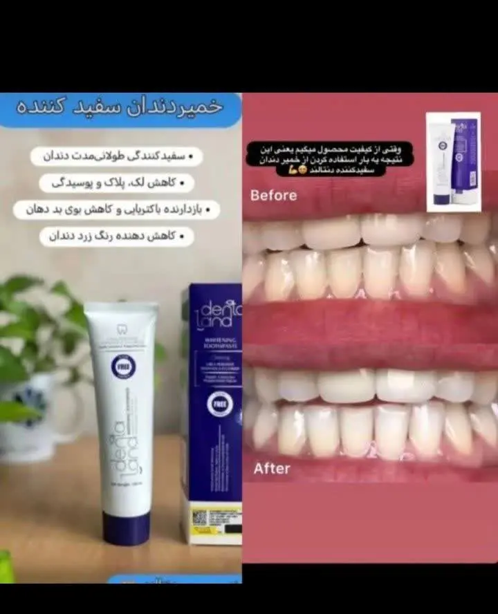 خمیردندان سفیدکننده دنتالند 🦷🦷
