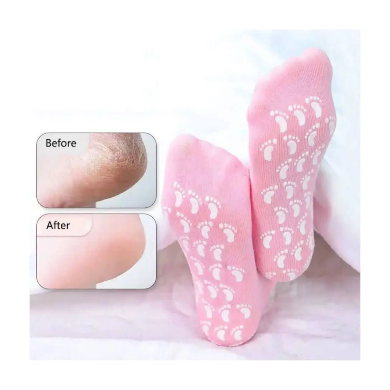 ✅این جوراب سیلیکونی🧦دائمیه...